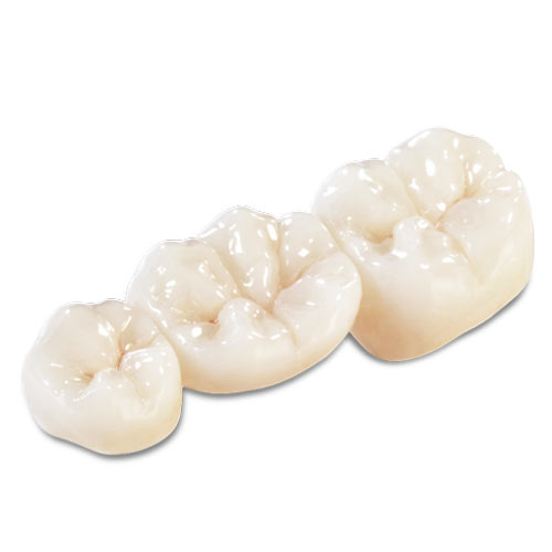 Zirconia Crowns Stomadent Lab Idaho