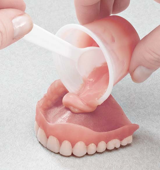 Rebasing a Denture