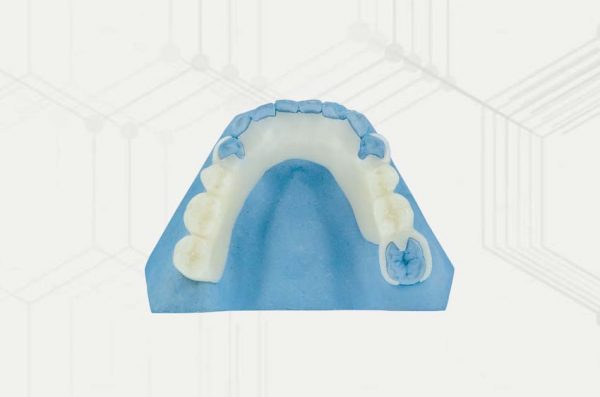 Zirlux Acetal Resin Partial Dentures - Stomadent Dental Lab