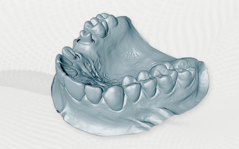 lasting impression dental lab