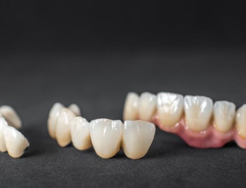 Zirconia Crowns: The Facts that You Need to Know