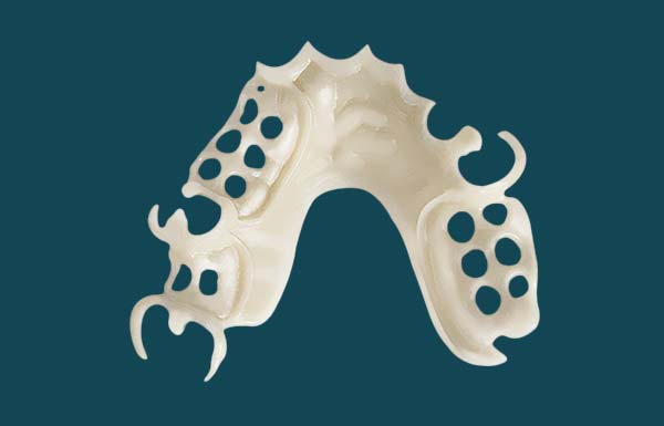 Zirlux Acetal Flexible Partial Dentures