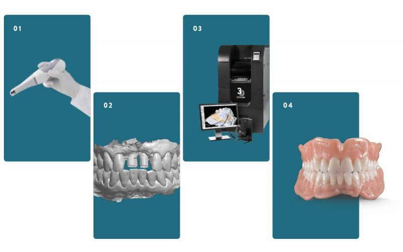 CAD/CAM Digital Denture Framework — Stomadent Dental Laboratory