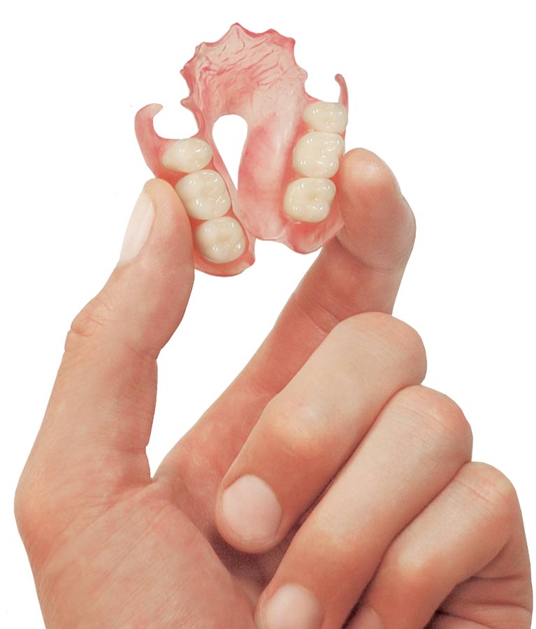 Valplast Partial Denture Framework — Stomadent Dental Laboratory