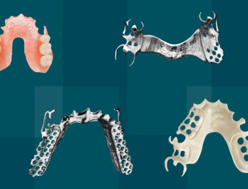 When a Dentist Should Choose Acrylic, Flexible or Metal Partial Dentures