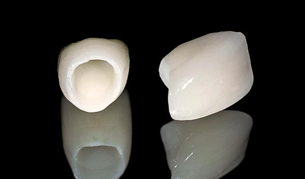 Porcelain fuzed Zirconia