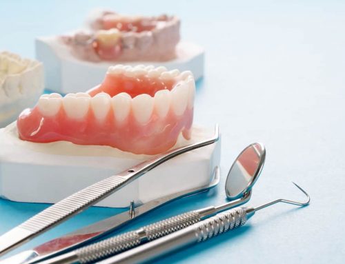 Interim Complete Denture Uses & Options
