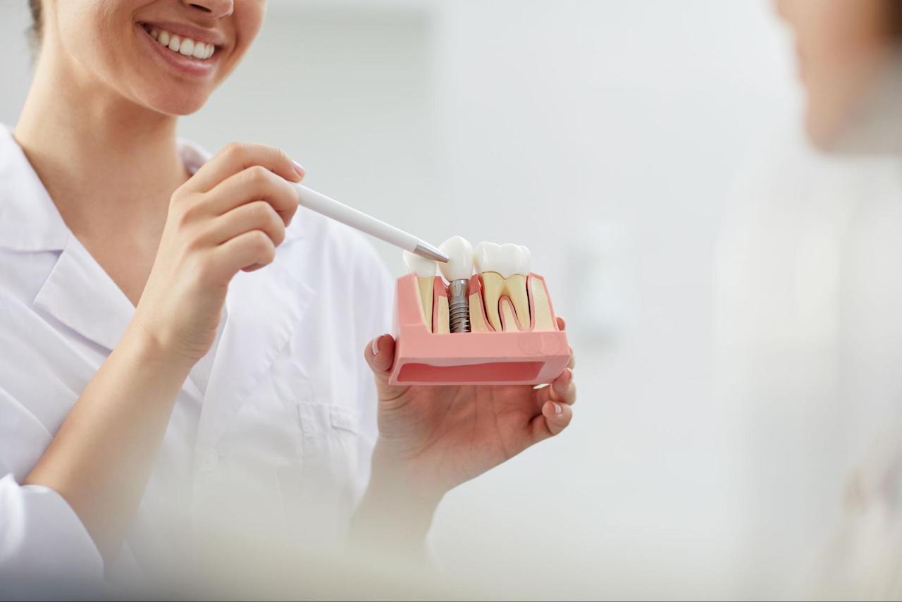 dental implant brands