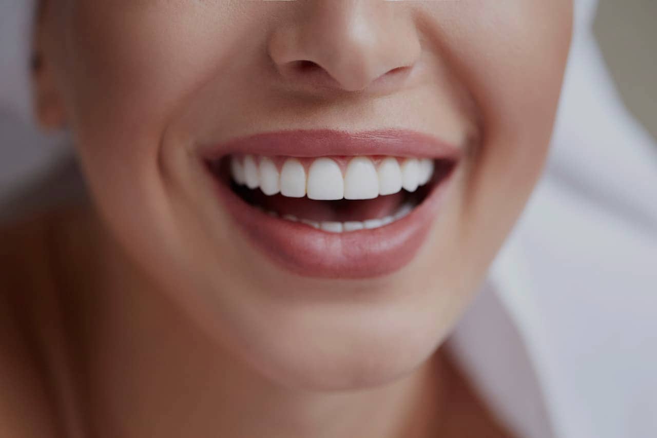 teeth prepared for veneers