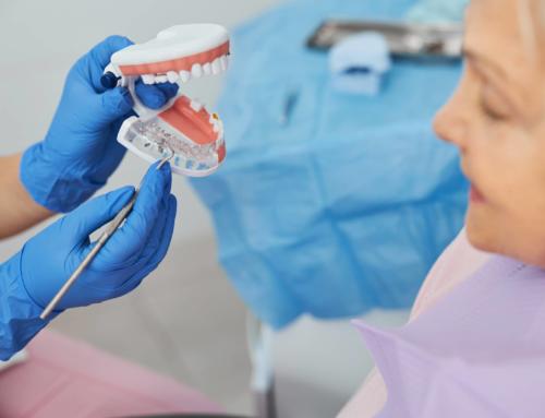 Custom Abutments: A Restorative Dental Implant Solution