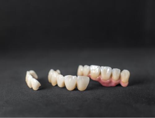 3D Printing of Dental Crowns: Premier Dental Lab