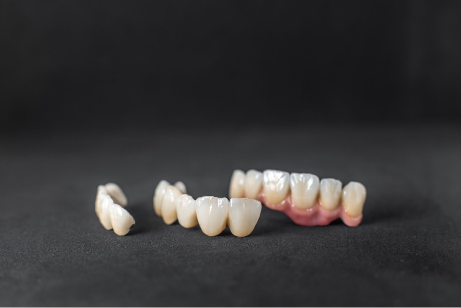 3d printing of dental crowns