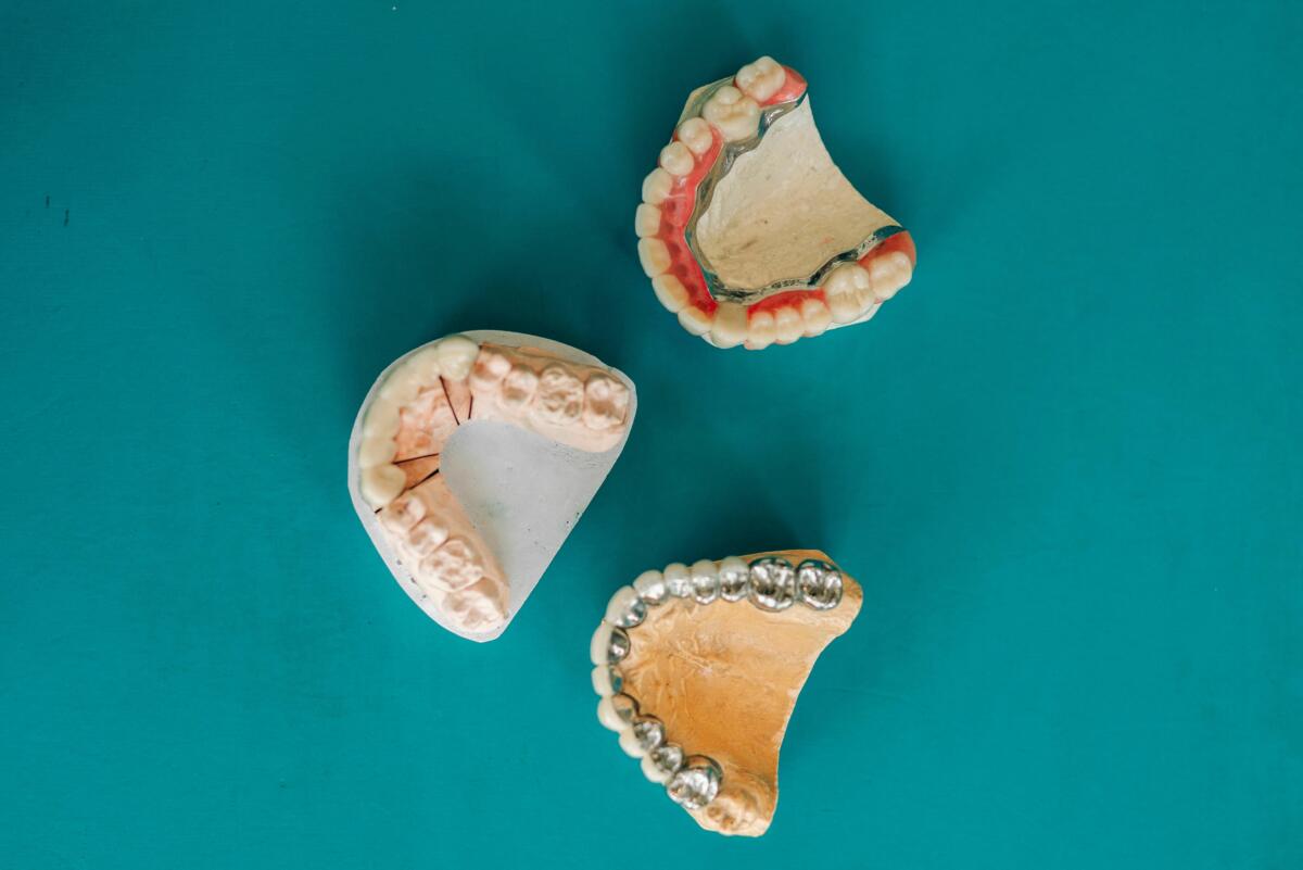 Partial Denture Clasp Types | Stomadent Dental Lab